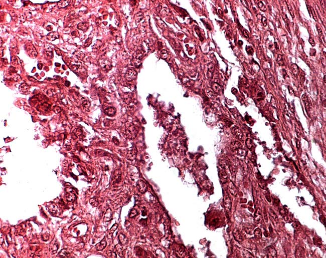 Trophoblastic surface of villi