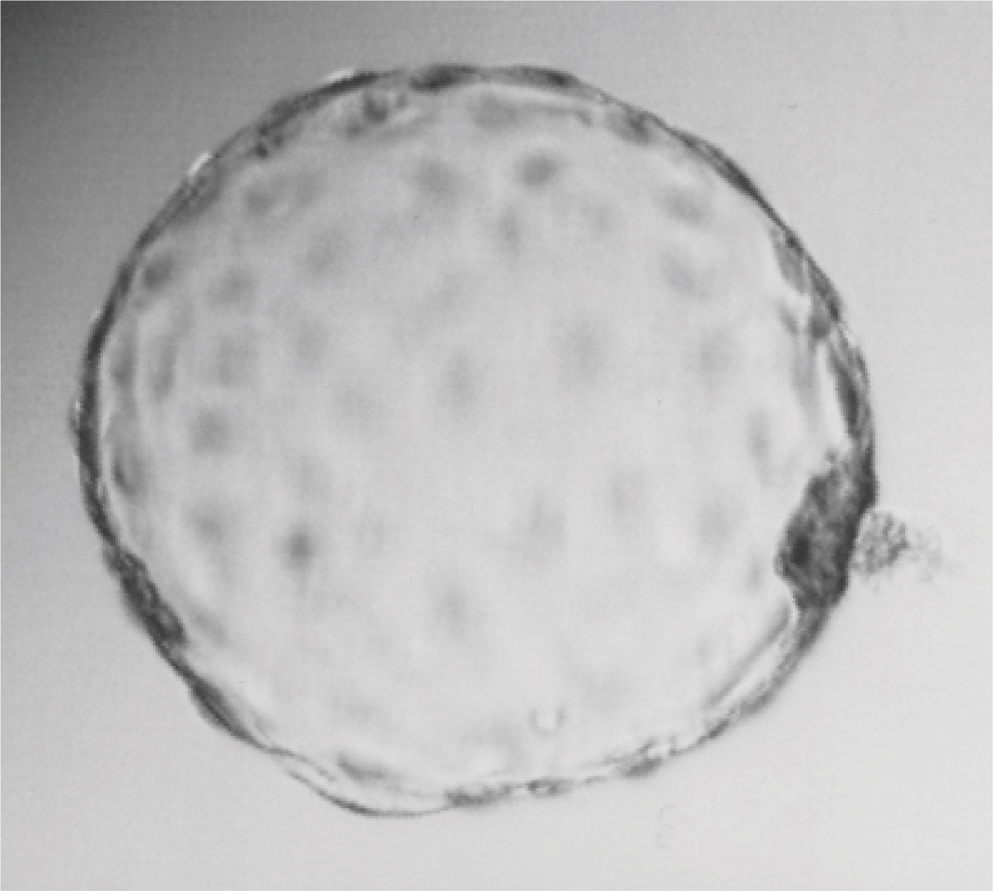 in-vitro-fertilization.jpg